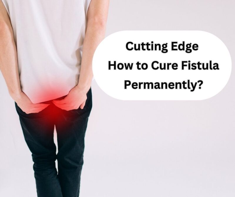 Cutting Edge How To Cure Fistula Permanently Dr Abhijit