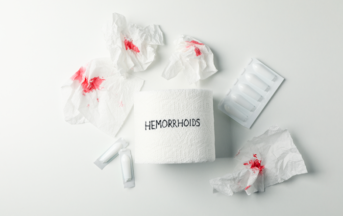 Best Hemorrhoids Surgery in Pune