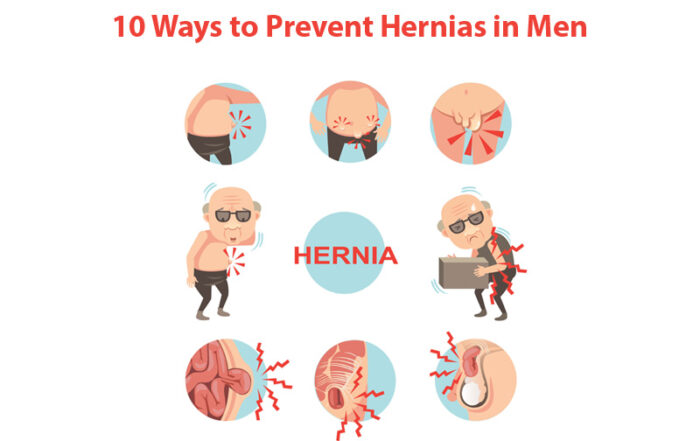 Hernia doctor in Pune
