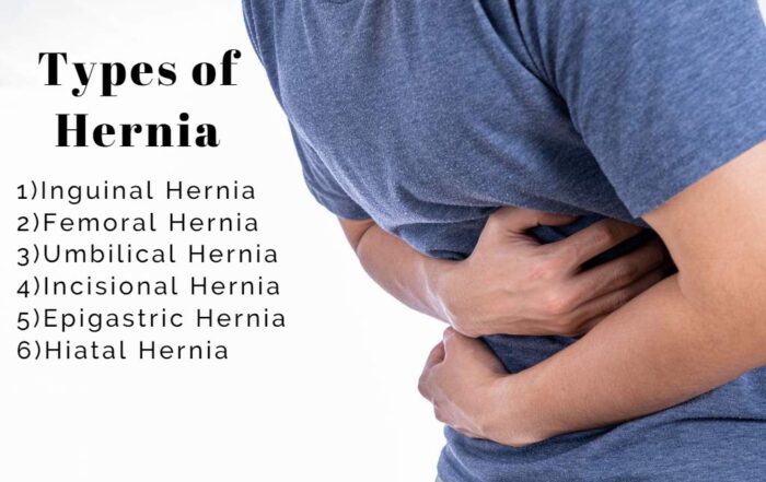 best treatent on hernia in pune