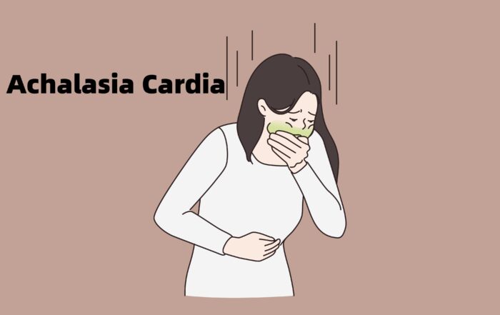 Best Achalasia Cardia Treatment in Pune