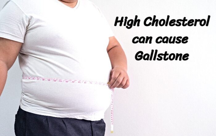 Best Gallstone Removal Treatment in Pune