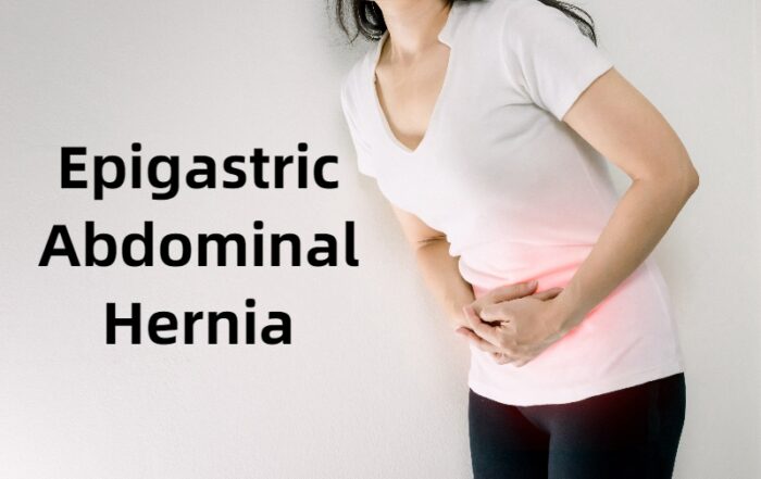 Best Epigastric Abdominal Hernia Treatment in Pune