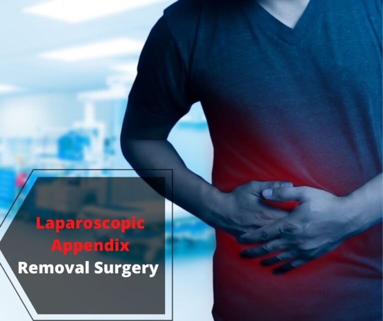 Laparoscopic Appendix Removal Surgery