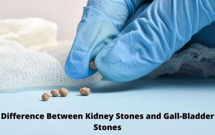 Difference Between Kidney Stones and Gall-Bladder Stones