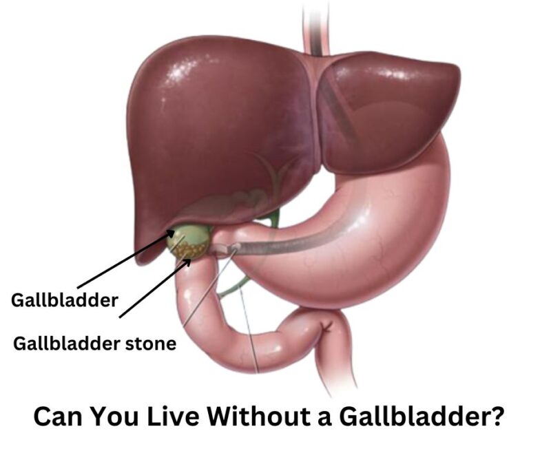 Can You Live Without A Gallbladder Dr Abhijit Gotkhinde