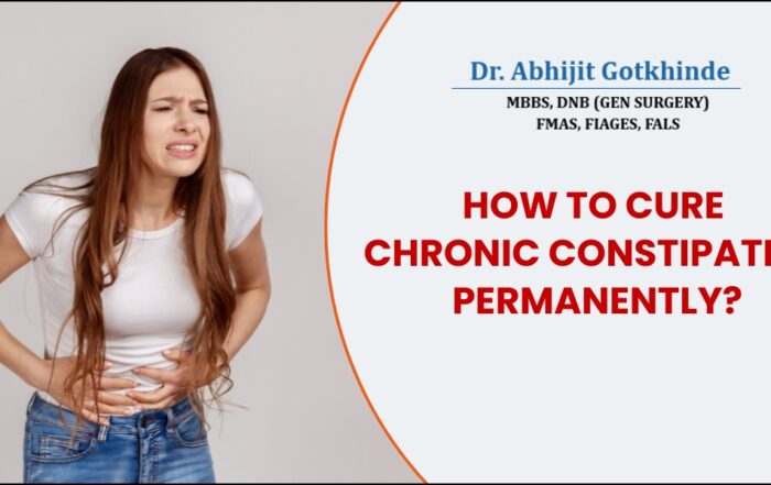 Chronic Constipation Treatment