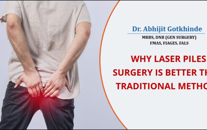 Laser Piles Surgery