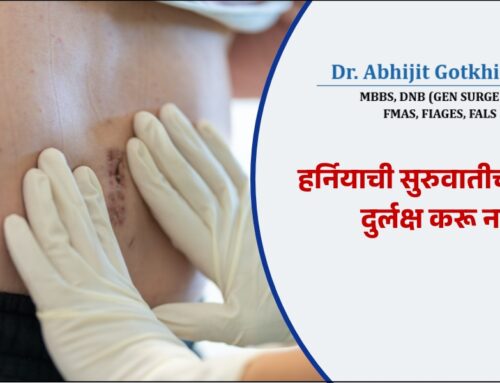 हर्नियाची सुरुवातीची लक्षणे – दुर्लक्ष करू नका