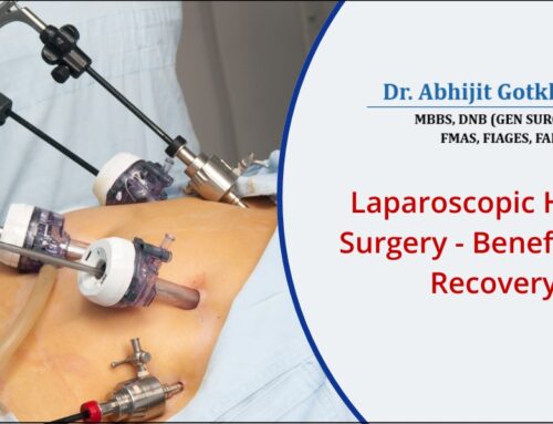 Laparoscopic Hernia Surgery: Benefits and Recovery