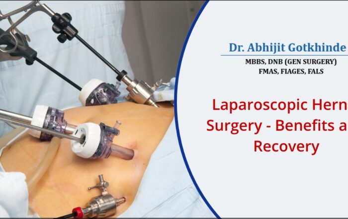 Benefits of Laparoscopic Hernia Surgery