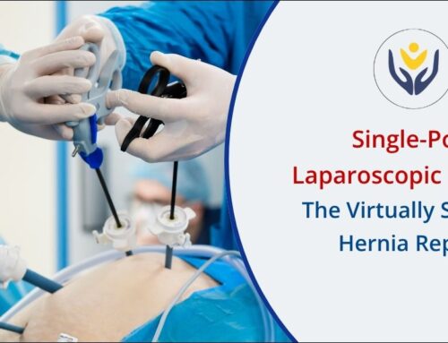 Single-Port Laparoscopic Surgery: The Virtually Scarless Hernia Repair