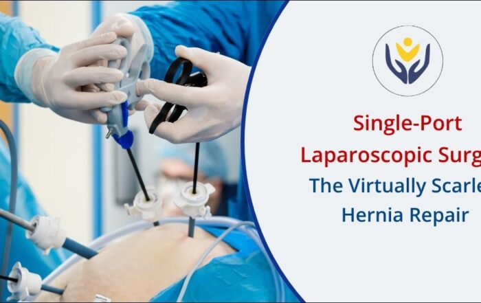 Single-Port Laparoscopic Surgery