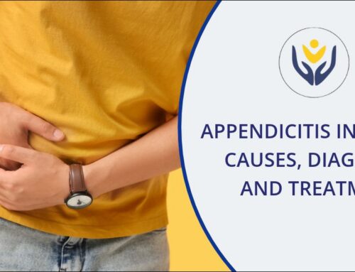 Appendicitis in Adults: Causes, Diagnosis and Treatment
