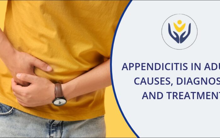 Appendicitis in Adults - Complete Guide